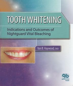 Tooth Whitening Indications and Out of Nightguard Vital Bleaching