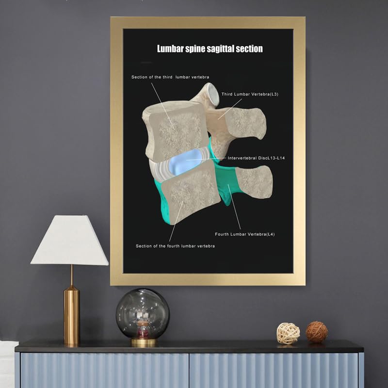 Image of Taanfu Body Educational Learning Anatomy Posters ，Lumbar Plane Art Lumbar Villi Anatomy Art Poster Digestive System Organs Illustration Small Intestine Physiology Anatomy Wall Art Villi