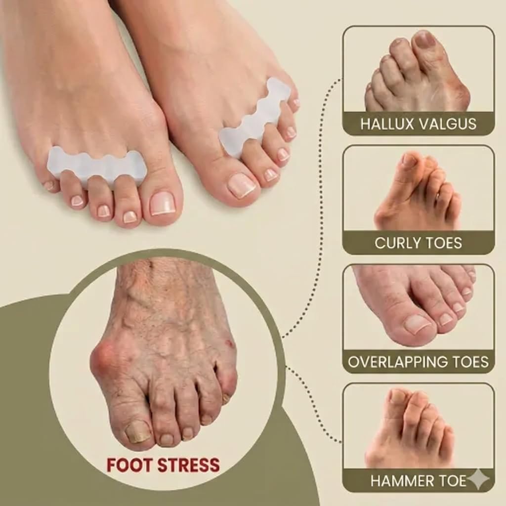8 Stück Weicher Zehenspreizer aus Silikon, Zehenspreizer Silikon, Gel-Zehenspreizer, Zehenstrecker für alle Zehen für täglichen Gebrauch in Schuhen, Hallux Valgus Zehentrenner