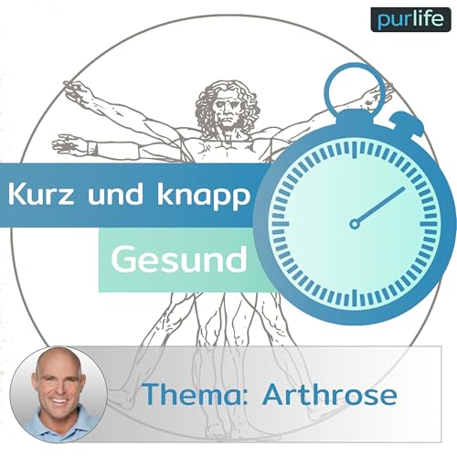Kurz und knapp gesund - Arthrose