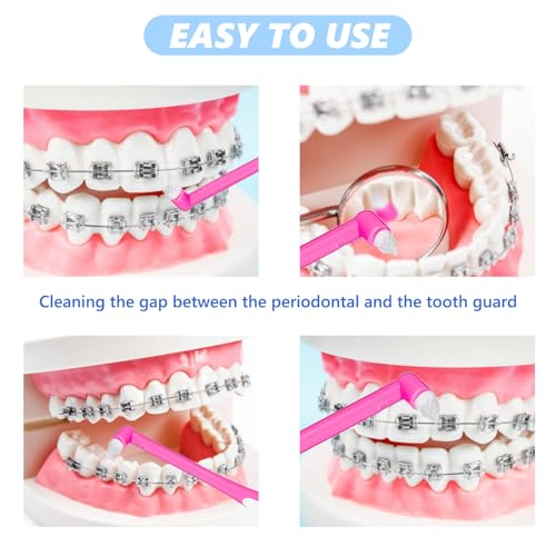 4 Stück Tuft Zahnbürste, soft Einbüschelbürste, Weich Einbüschelzahnbürste, Single Interdental Zwischenraum Bürste für kieferorthopädische Zahnspangen