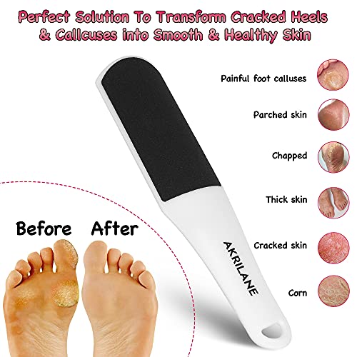 Akrilane AWF501 Pedicure Foot File | Double Sided Callus Remover | Foot Rasp Removes Dead Skin, Corn, Cracked Heels, Hard Skin For Wet And Dry Feet | Large Curved Foot File Scrubber thumb #5