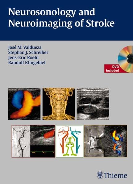 Neurosonology and Neuroimaging of Stroke: A Teaching Atlas