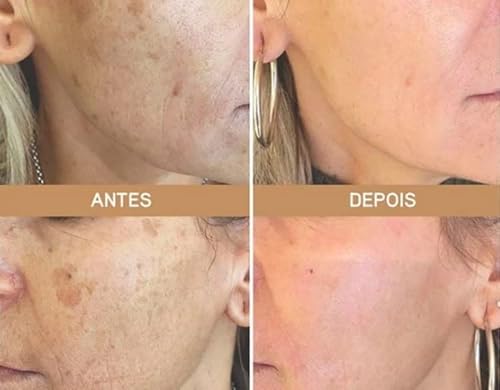 Serum Rosa Amazônica Mosqueta+ácido Hialuronico+retinol+verisol