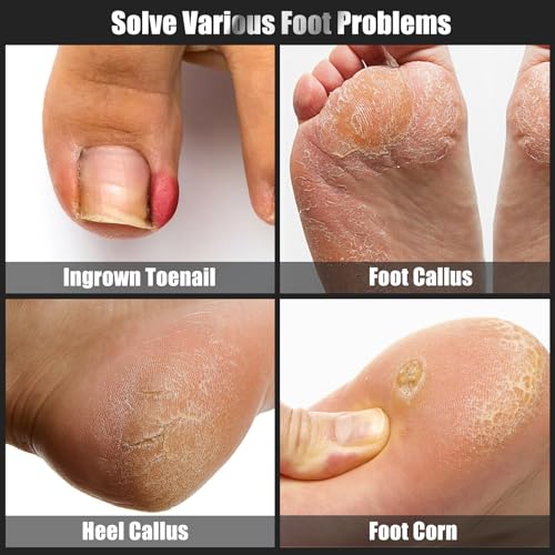 7-Piece Ingrown Toenail Treatment Set