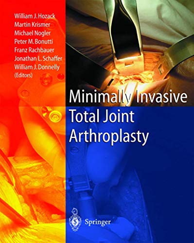 Minimally Invasive Total Joint Arthroplasty