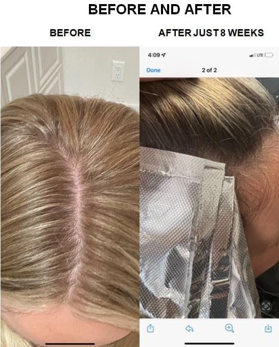 FULL BODY IMPACT Liquid Collagen Protein Supplement 16,000mg (16g) of Hydrolyzed Collagen Peptides Types I & III for Healthy Hair, Skin, Nails & Joints (32oz Bottle), Sugar Free (Peach Mango Vibes)