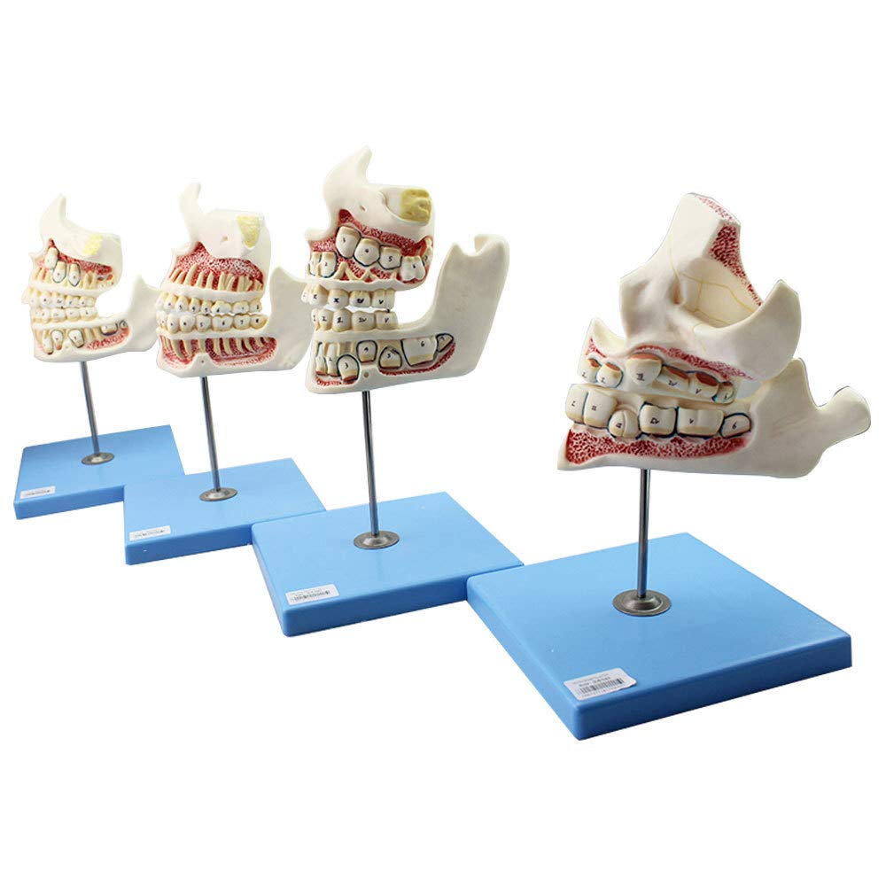 Denti Decidui Denti Permanenti Modello Sviluppo Dei Denti E Mascella Bambini Crescita Denti 4Stadi Modello Sviluppo Dentatura E Della Mascella Bambini Cura Dentale Orale Mascella Dentatura Denti
