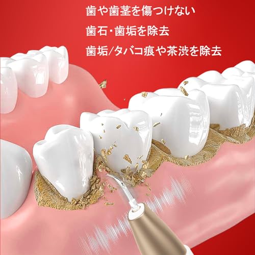 Micfendy 超音波歯クリーナー 歯間クリーナー 口腔洗浄器 USB 充電式 携帯用歯清潔器 5モード調節可能 LEDライト クリーニングキット の商品画像 4