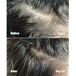 SickScience PowerCycle Exosome Hair Growth Serum - Clinically Advanced Scalp Treatment for Thinning Hair, Hair Loss Prevention & Regrowth - Lightweight Formula for Women & Men, Without Minoxidil, 60mL - Image 3