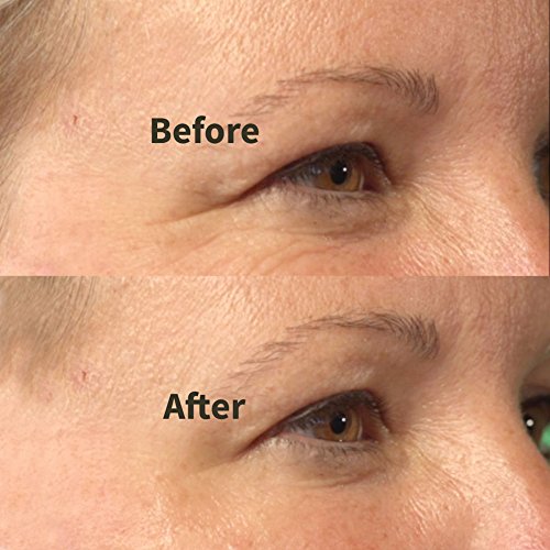 Instant Firming Maxi Lift Serum - Two Minute Face Lift For A Younger Look #TOP3