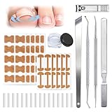Ingrown Toenail Corrector Set with Correction Strips, Professional Ingrown Toenail Removal Kit Pedicure Tool Set, In Grown Toe Nail Remover Curve Tape at Home for Men Women