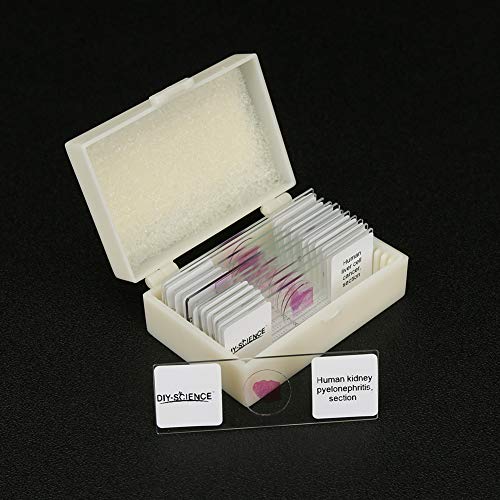 Prepared Human Pathology Microscope Slide Set, 12Pcs Research-Quality Prepared Tissue Microscope Slides Of Human Diseases (Human Pathology) #TOP2