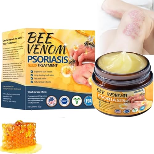 Crema Avanzada Para El Tratamiento De La Psoriasis Con Veneno De Abeja Ourlyard, Ungüento Para El Tratamiento De La Psoriasis, Adecuada Para Todos Los Tipos De Piel (1pcs)