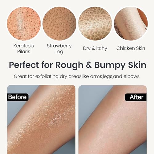Yiclick 4 Stück Peelinghandschuh Peeling Handschuhe - Exfoliating Gloves, Körperpeeling Peeling Körper Gesicht, Badeschwamm, Duschschwamm, Peeling Luffa Schwamm Waschlappen Rückenbürste Badezubehör