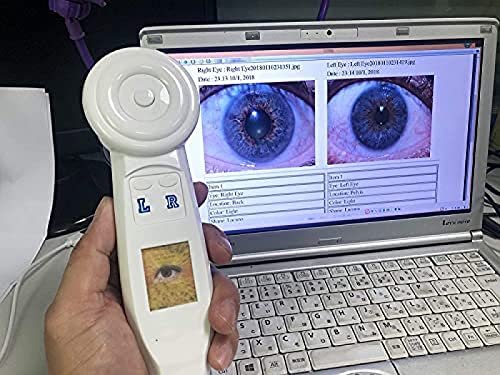 Câmera portátil da iridologia do computador de 5.0 mp usb, câmera do computador da iridologia do ana