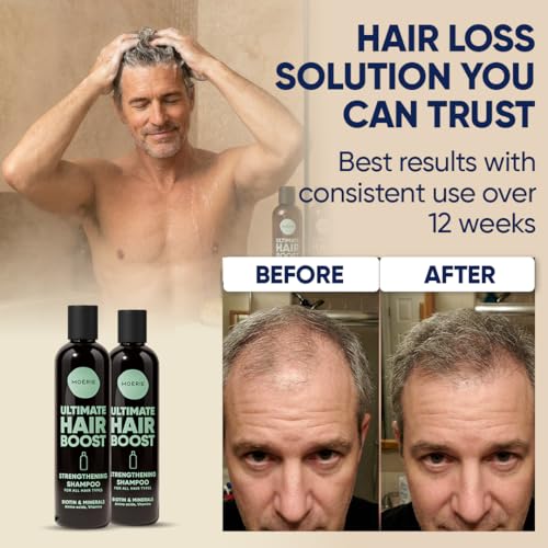 Image of Moerie Hair Growth Shampoo for Men and Women, Hair Loss Solution with Biotin and Rosemary, Thickening Shampoo for Thinning Hair - Ultimate Boost for All Hair Types