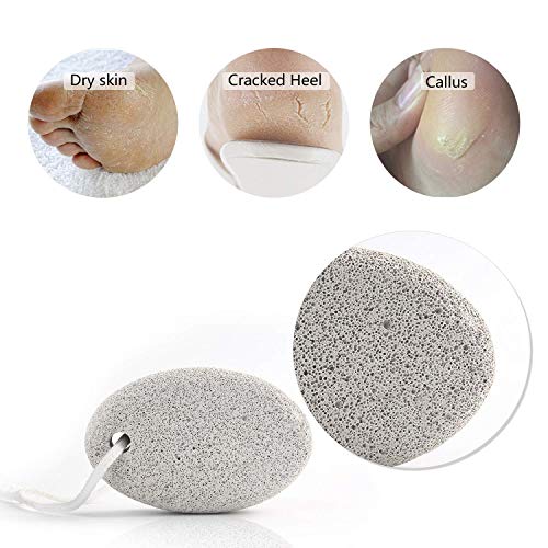 Natural-Pumice-Stone-for-Feet-2-PCS-PHOGARY-Lava-Pedicure-Tools-Hard-Skin-Callus-Remover-for-Feet-and-Hands-Natural-Foot-File-Exfoliation-to-Remove-Dead-Skin