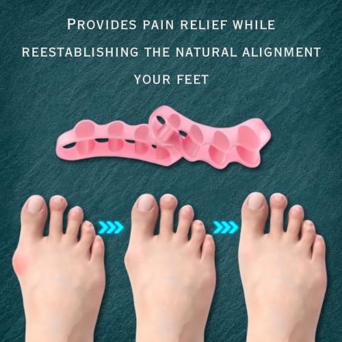 Image of Wonder Care Silicone Toe Separator For Feet Gel Pads Big Toe Corrector Bunion Straightener Yoga Stretcher Hammer Bunion [Pink,Pair of 3-6 Pieces]