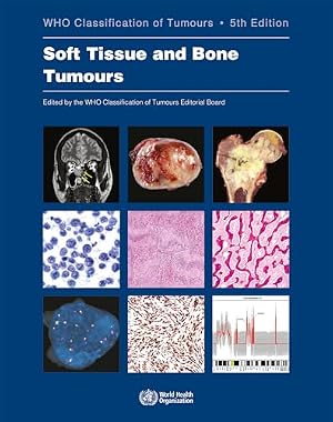 WHO Classification of Tumours of Haematopoietic and Lymphoid Tissue [OP ...