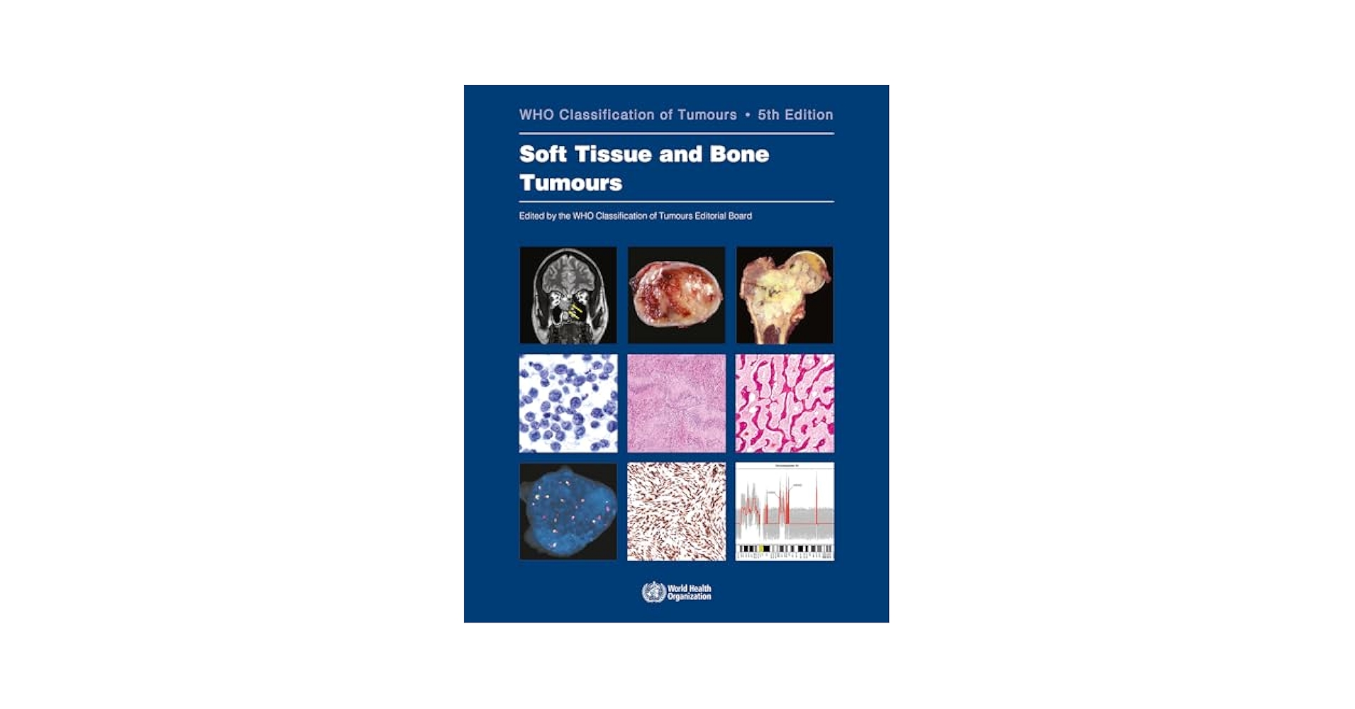 【未開封】WHO Classification of Tumours of th WHO Classification of Tumours of the Lung, Pleura, Thymus