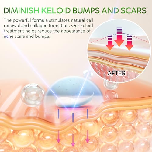Tobcharm TOBCSCAR002 Advanced Keloid Bump Removal Gel: Silicone Keloid Scar Removal Cream thumb #1