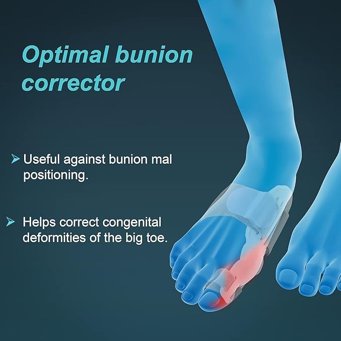 Bunion Splint, White, Universal Size, 1 Unit, Metal, Foam