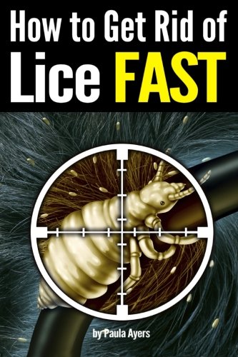 How to Get Rid of Lice FAST: An Essential Guide to Getting Rid of Head Lice for Good How to Get Rid of Lice FAST: An Essential Guide to Getting Rid of Head Lice for Good