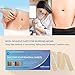 Aroamas Professional Silicone C-Section Scar Removal Sheets, Soft Adhesive Fabric Strips, Drug-Free, Relieves Itching, Remove Keloid Scars, Acne. 5.9