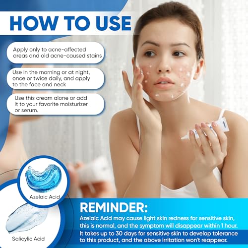 AOBBIY Azelaic Acid Cream: Azelaic Acid For Face - Premium Azelaic Acid Cream - Face Skin and Beauty Care - Azelaic Acid Facial Cream (1 Oz)
