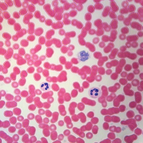 Human Blood Film Slide, Smear, H&E