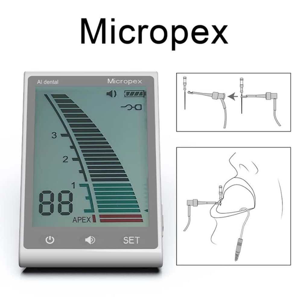 Localisateur D'apex Endodontique,Accessoires De Localisateur D'apex, Convient à la Mesure de la pulpe, de la nécrose pulpaire, de la parodontite apicale et de la Longueur des Dents