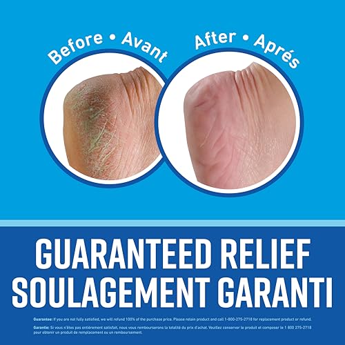 O'Keeffe's Healthy Feet Foot Cream, Healing Moisturizer, Relieves and Repairs Extremely Dry Cracked Feet, Instantly Boosts Moisture Levels, Two 3.2oz/90.7g Jars, (Pack of 2) - Image 5