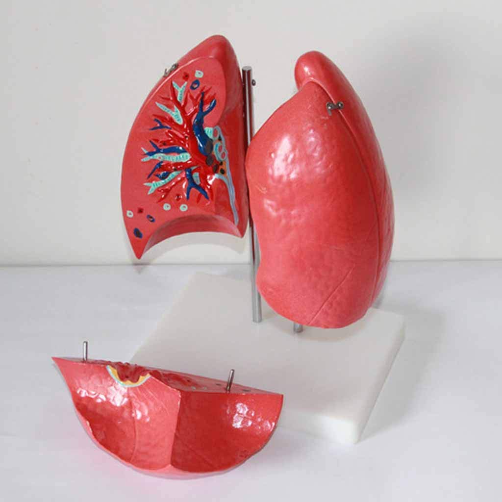 Modello Anatomico Medico del Polmone - Modello Anatomico Dell'Organo Umano - Modello del Polmone Umano - per L'Insegnamento del Modello di Formazione Speciale, Aiuto alla