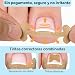 Imagen de MSLHUB Set de corrección de uñas encarnadas de los pies