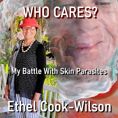 Page de couverture de Who Cares?: My Battle with Skin Parasites