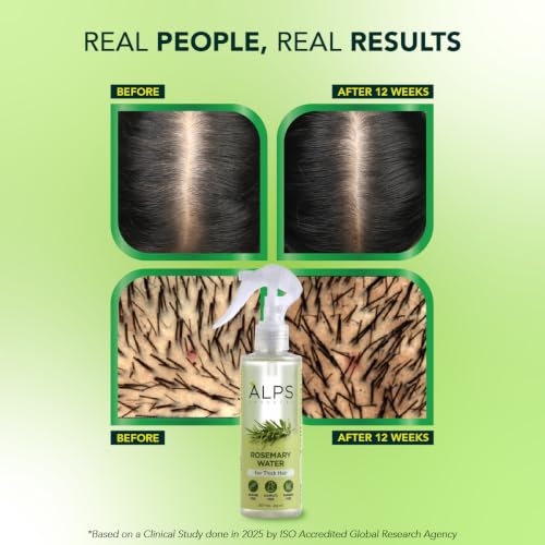 Image of Alps Goodness Rosemary Water Spray for Hair Growth (250ml) | Clinically Proven (In Vivo Tested) to Reduce Hair Fall & Promote Regrowth | 100% Natural Rosemary Extract | Leave-On Scalp & Hair Spray For Men & Women