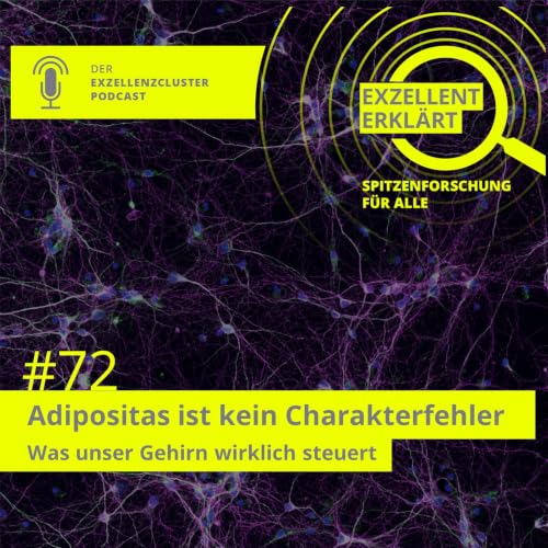 Adipositas ist kein Charakterfehler &ndash; Was unser Gehirn wirklich steuert