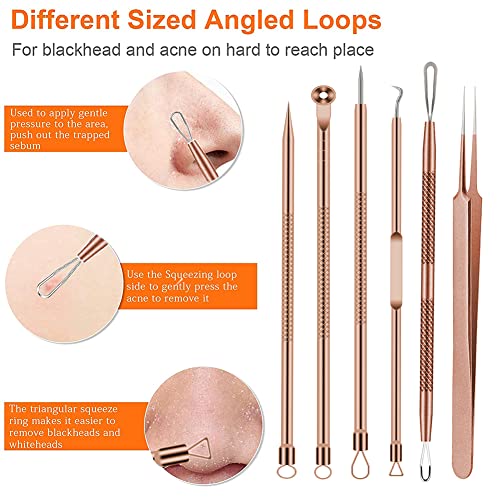 Outils points noirs efficaces contre acné et imperfections - 3