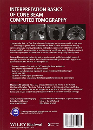 Interpretation Basics of Cone Beam Computed Tomography
