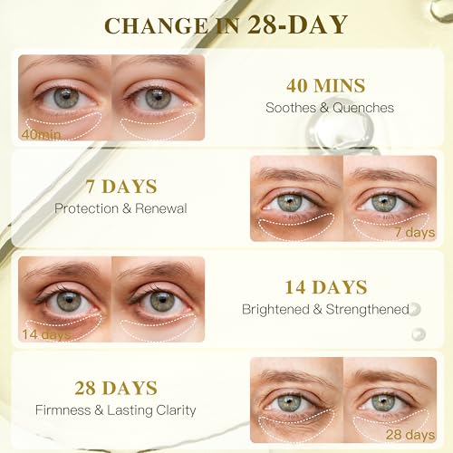 ICIKOL Turmeric Vitamin C Under Eye Patches, Eye Mask for Puffy Eyes and Dark Circles, Deep Hydrating Under Eye Mask Patches for Eye Bags Treatment, Under-eye Skincare for Soothing (12 pairs)