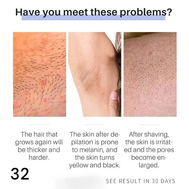 Image of ZeroPathy Ayurvedic Hair Growth Stop cream 35ml - Use After Threading, Shaving or Waxing - Apply After Hair Removal Cream or Spray - 90 Days Permanent Hair Vanish for Face, Legs & Private Areas