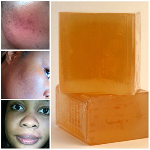 Tumeric mask,Turmeric soap acne,Skin Brightening SoapKojic AcidHoney