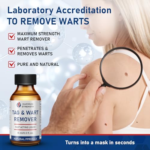 Image of inchSTAY STOKED inch Wart Remover, 15ml Liquid Wart Freeze Off - Salicylic Acid Formula with Brush Applicator-QQ1