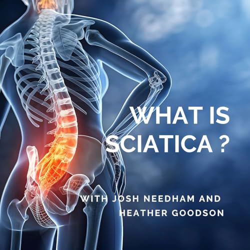 What is sciatica? Podcast Por  arte de portada