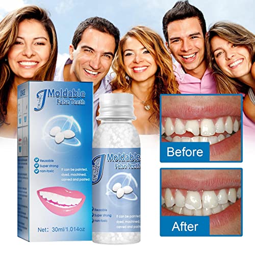 Temporary Tooth Repair Kit Teeth And Gaps Falseteeth Solid Glue Denture Adhesive For Fake Teeth Missing Tooth Make Smile Confidently (30G) #TOP1