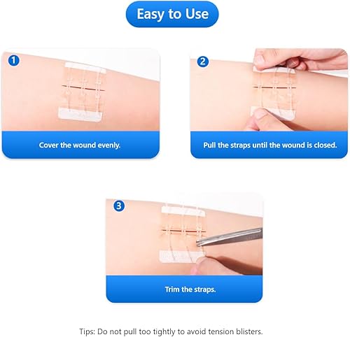 Miniatura 6 de Tiras de cierre de heridas de emergencia, vendajes de mariposa, suturas de puntada, vendajes adhesivos para primeros auxilios, reparación de