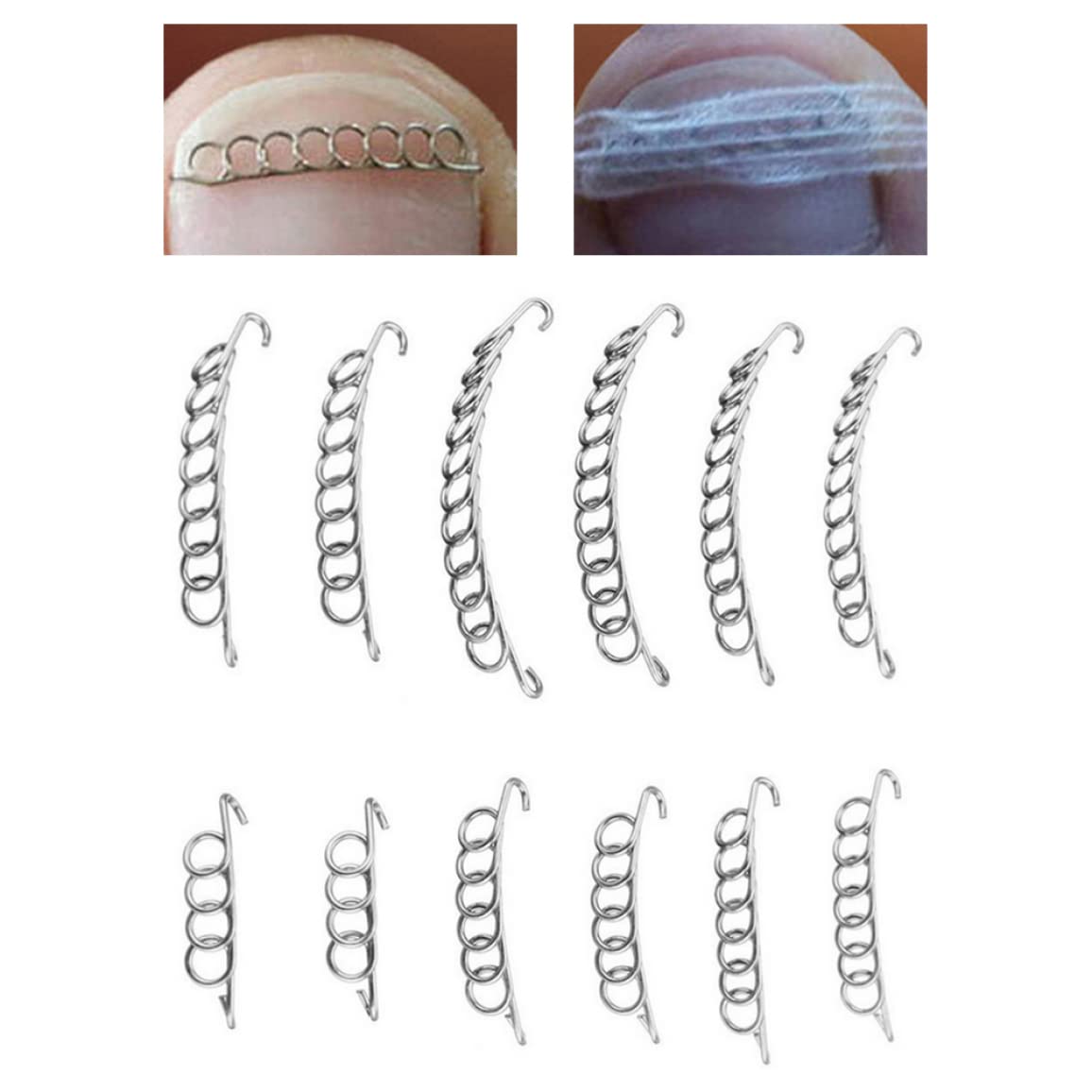 Filo correttore di punta incarnita, filo di correzione dell'unghia del piede Ingrimato di pedicure utensile inossidabile Recupero di unghie in acciaio inossidabile correttore 12pcs 12pcs