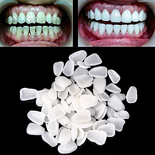 Buy DBSUN 2in1 Teeth Veneers and Thermal Beads ReplacementKit.Used to