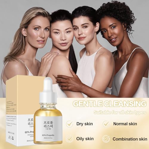 Hidratante facial hidratante de própolis e niacinamida, sérum que aumenta o brilho para o rosto para